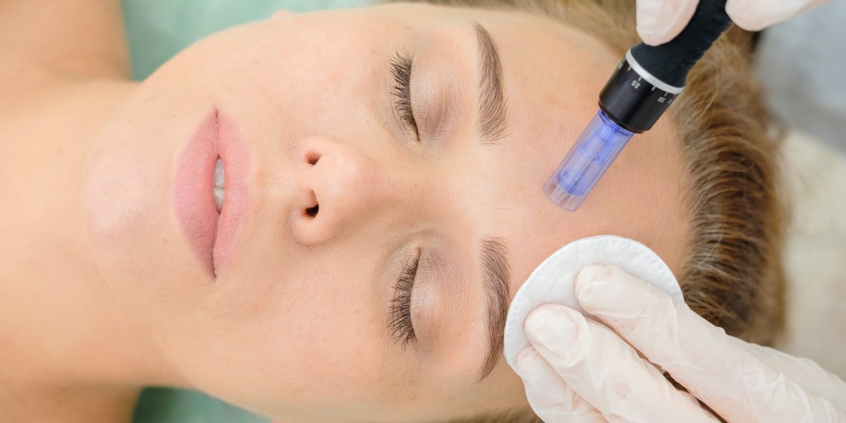 Beverly Hills Microneedling: The Secret to Radiant, Youthful Skin