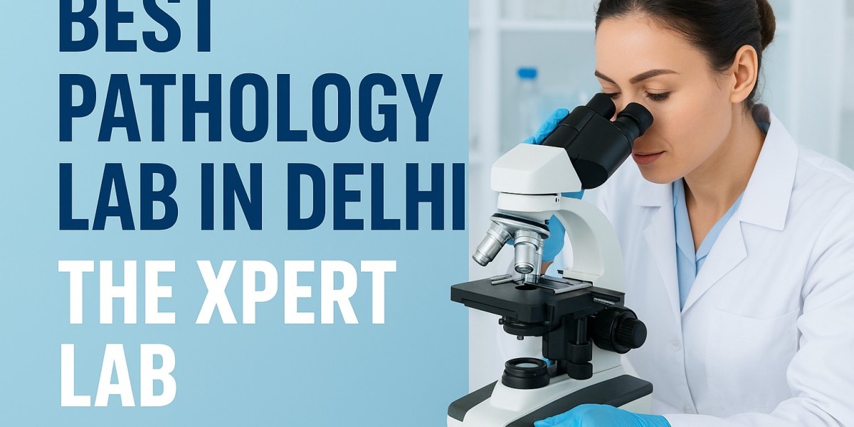 Blood Test Lab in Noida – The Xpert Lab: Excellence in Every Diagnosis