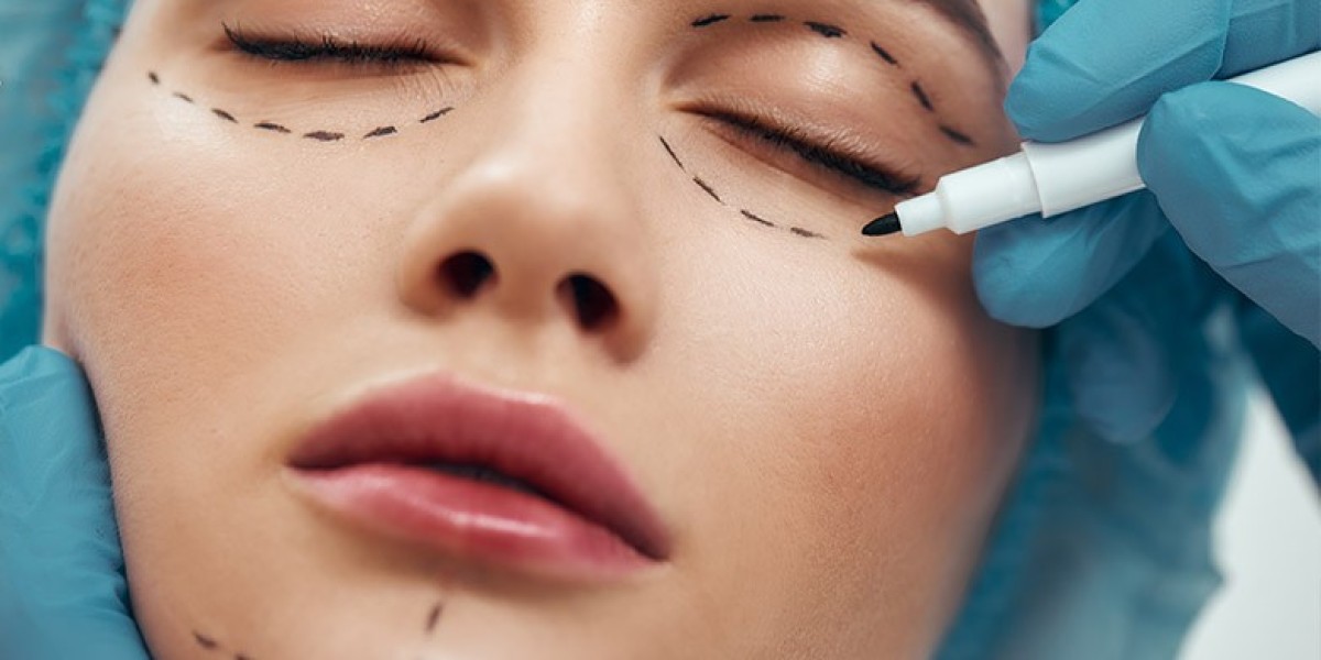 Transform Your Look with Eyelid Surgery In Islamabad