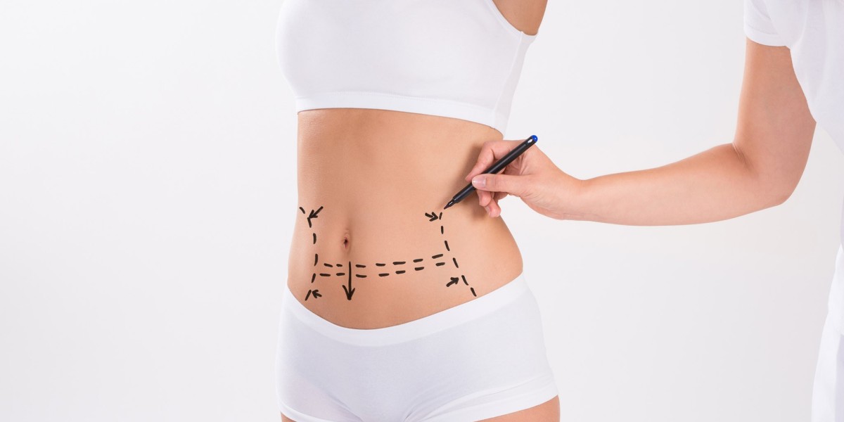 Reshape Your Abdomen with the Most Trusted Tummy Tuck Treatment in Islamabad
