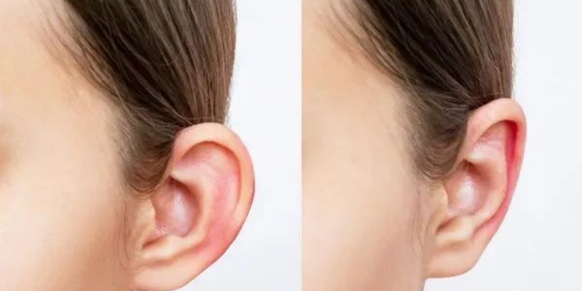 Ear Reshaping for Asymmetrical Ears in Islamabad