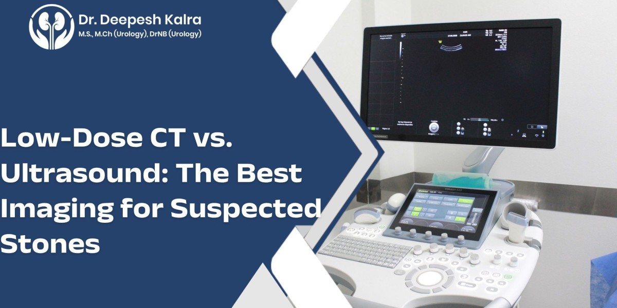 Low-Dose CT vs. Ultrasound: The Best Imaging for Suspected Stones