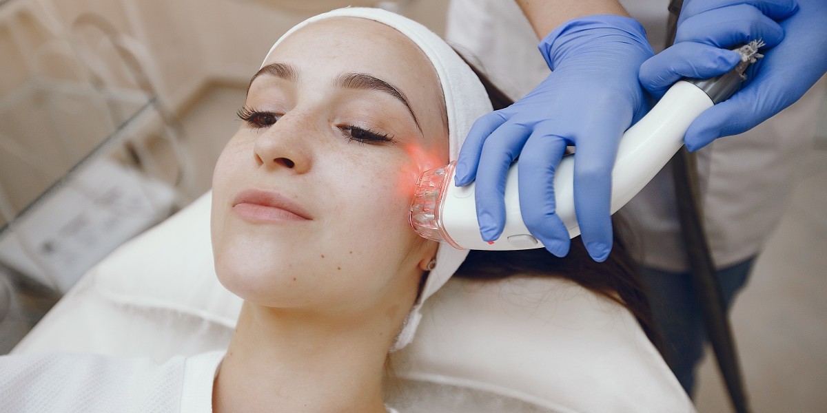 Laser Acne Treatment: Benefits and What to Expect?