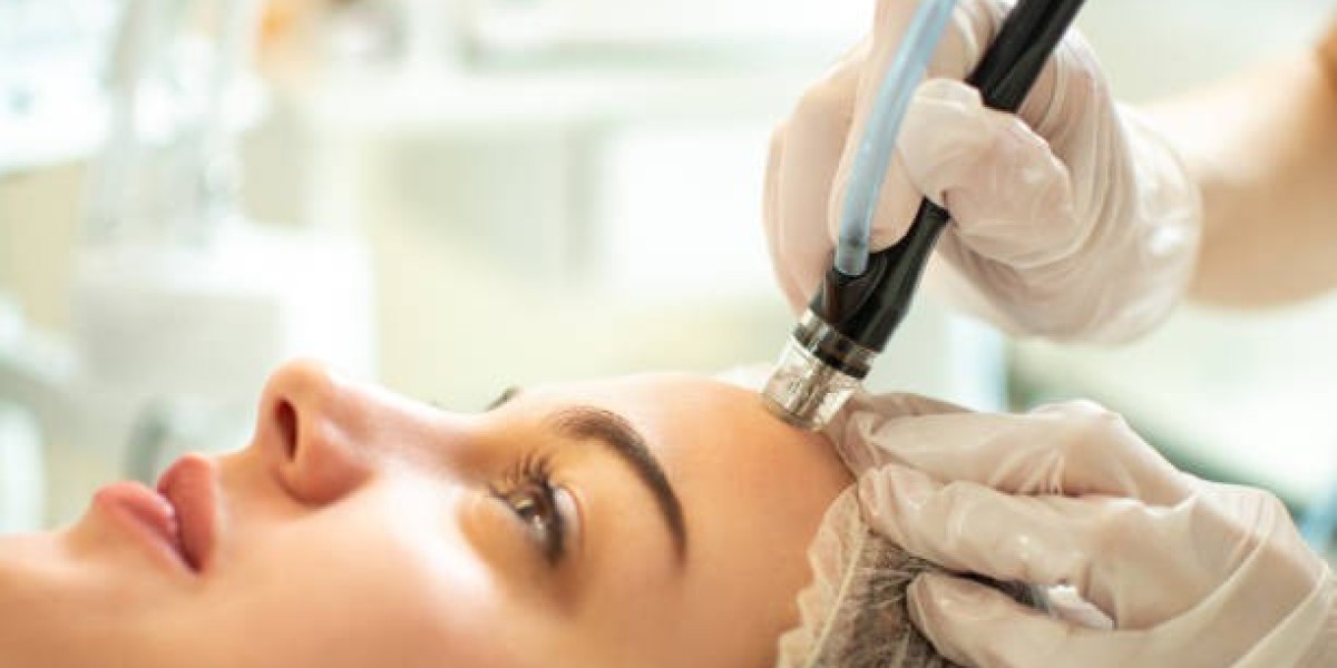 Hydrafacial Treatment in Dubai for Acne-Prone Skin