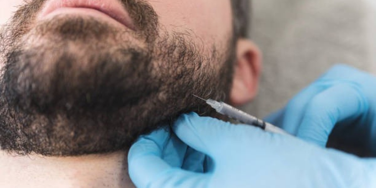 Achieve the Perfect Beard with Hair Transplant in Dubai