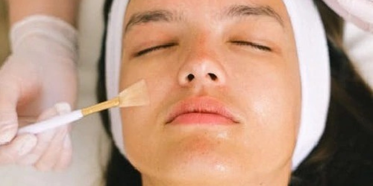 How Often Can You Get a Chemical Peel?