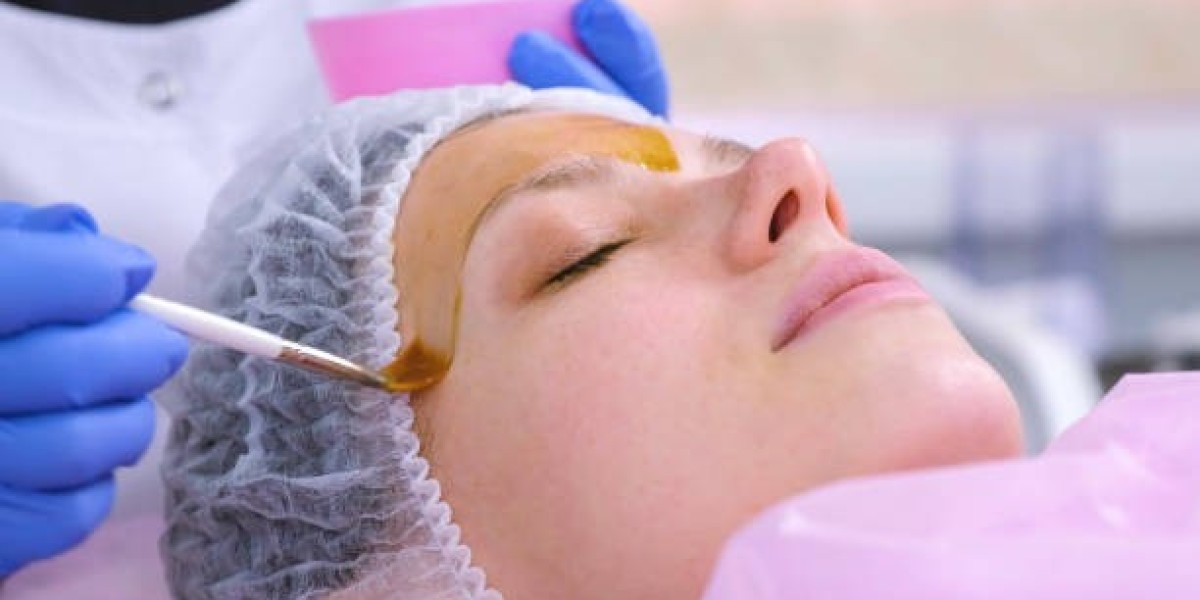How Chemical Peels in Dubai Can Reduce Acne Scars and Pigmentation