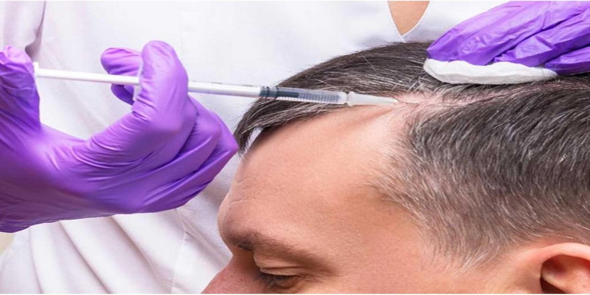 PRP Hair Treatment in Riyadh for Hair Regrowth