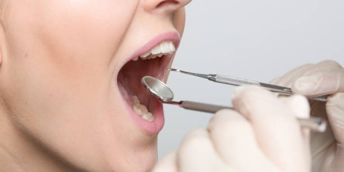 Navigating Dental Filling Cost Options
