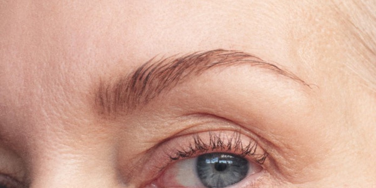 How Can I Reduce Fine Lines Naturally?