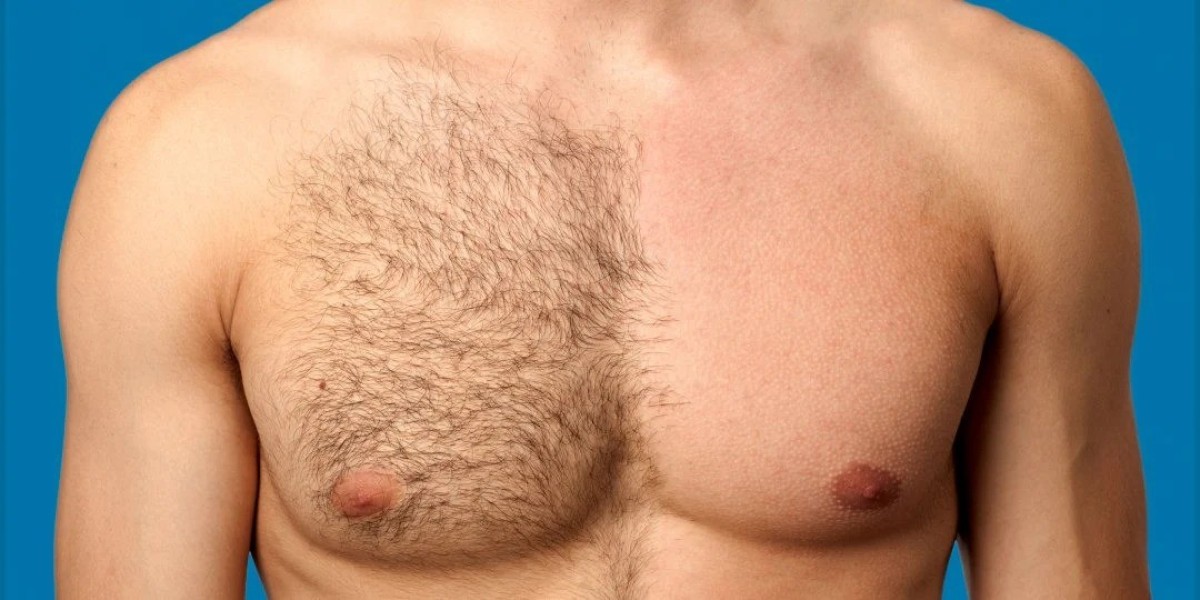 Does Body Hair Transplant in Dubai Give Natural Looking Results?