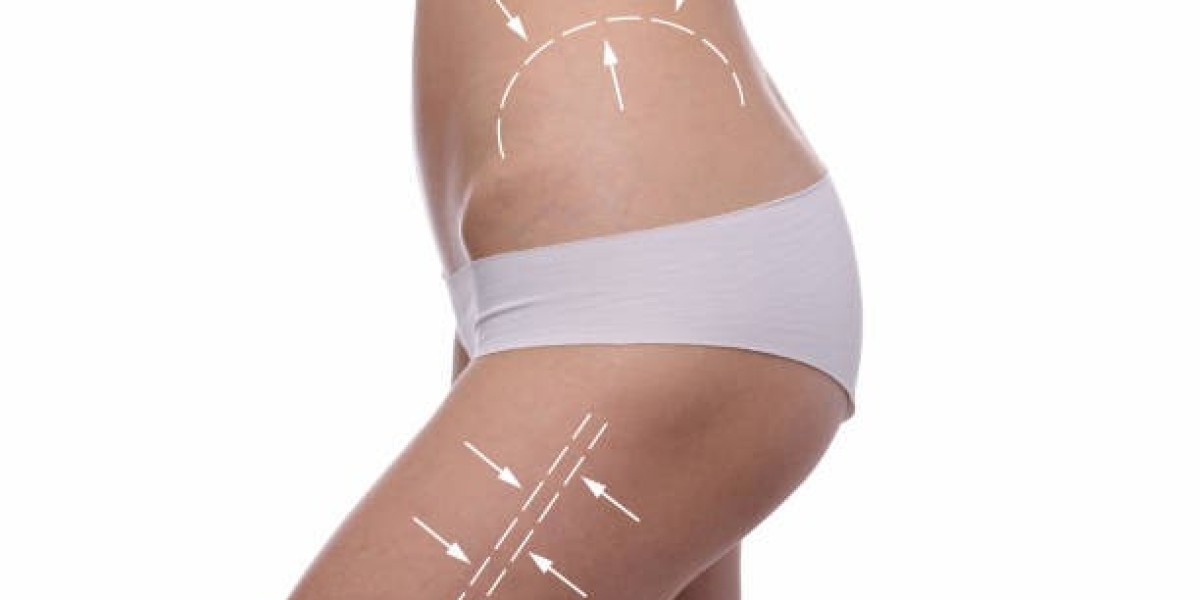 How Body Sculpting Procedure Targets Specific Body Areas