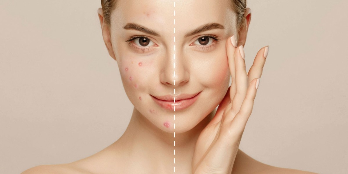 Is Dynamic Life Clinics Right for Your Beauty Goals?