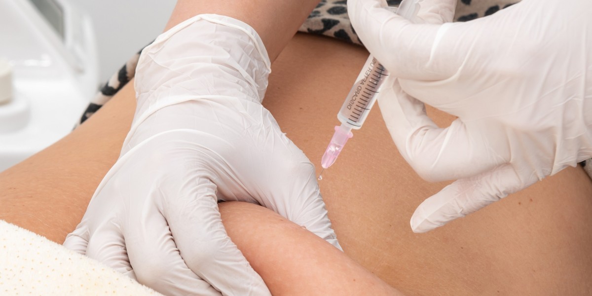 Lipolysis Injections in Riyadh Achieving a Contoured Look