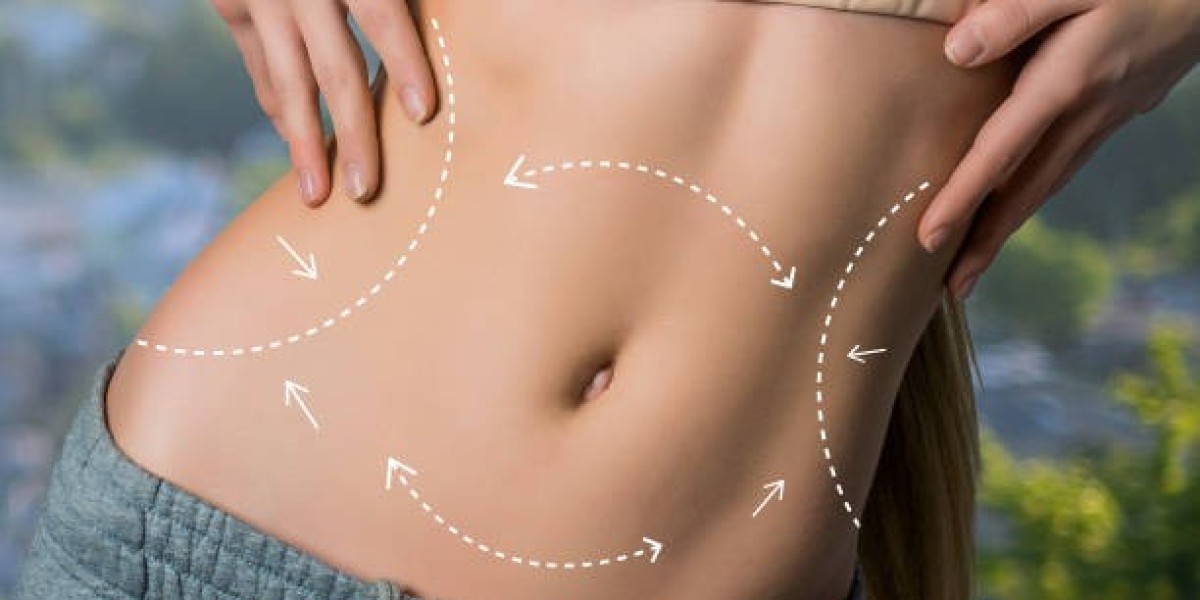 Liposuction Procedure and Lymphatic Drainage Massage