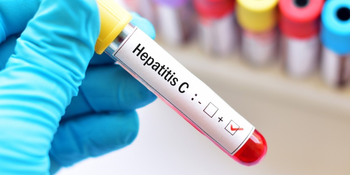 Can Lifestyle or Medications Affect Hepatitis C Test Results?