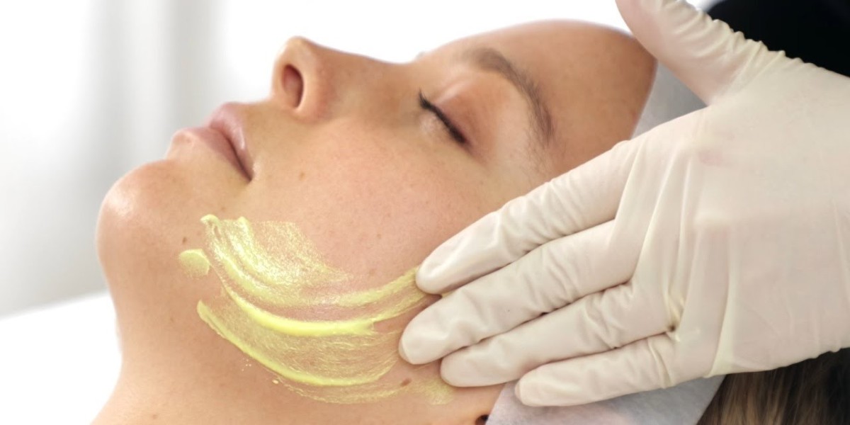Modern Chemical Peels in Riyadh Solutions