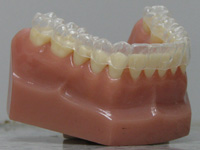 Invisalign Braces Miami  | Brickell Braces | Miami Invisalign | Key Biscayne