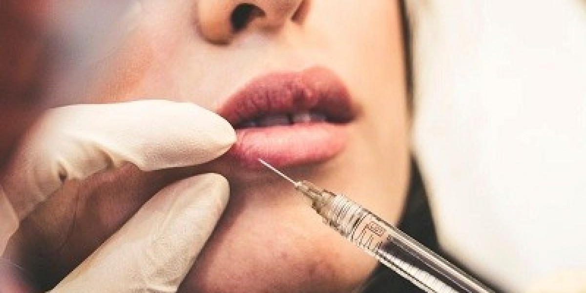 How to Correct Uneven Lips With Fillers Riyadh Experts Explain