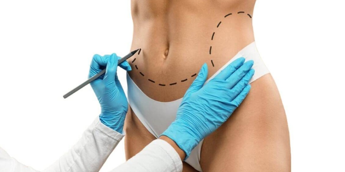 Thigh Liposuction: Inner vs Outer Thighs—Which Makes a Bigger Difference?