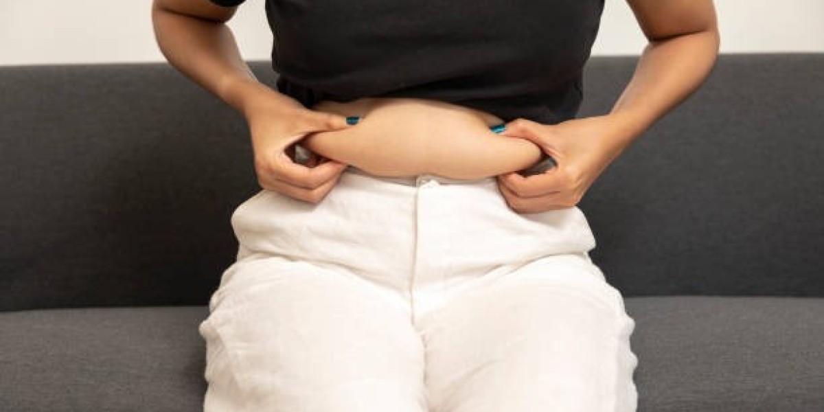 Full Tummy Tuck Surgery for Loose Skin in Riyadh