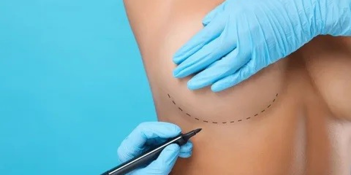 What Are the Different Types of Breast Implant in Islamabad?