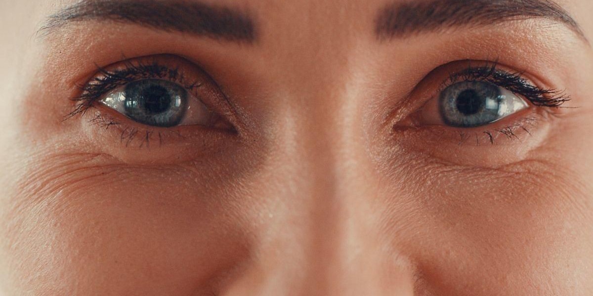 Fine Lines and Wrinkles Explained: Why Skin Ages Over Time