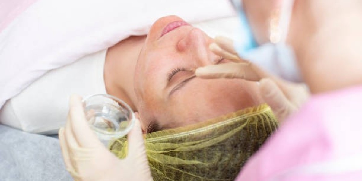 Top Questions About Chemical Peels in Dubai Answered by Experts