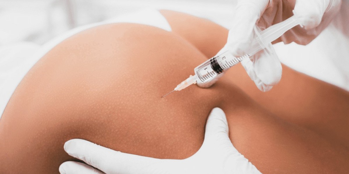 What Is Buttock Augmentation and How Does It Work?