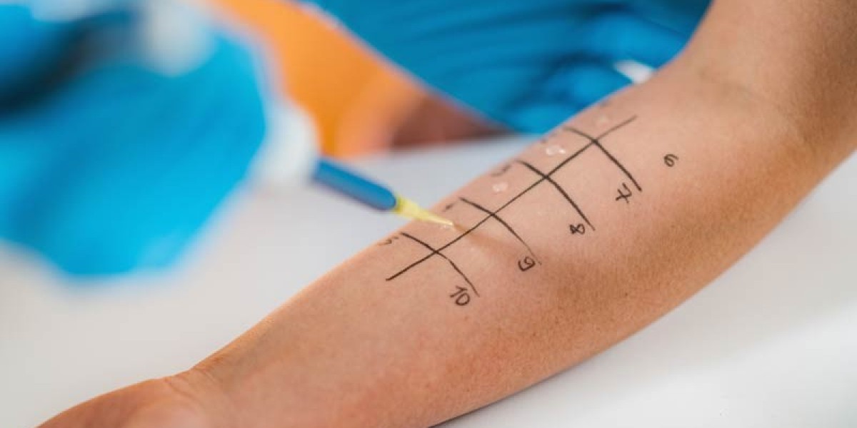 Allergy Testing: Accurate Diagnosis for a Healthier Life