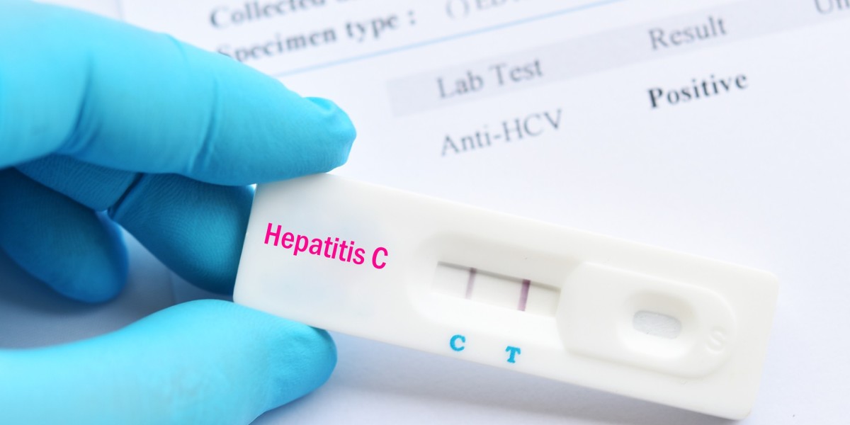 Hepatitis C Test in Dubai: Understanding the Results