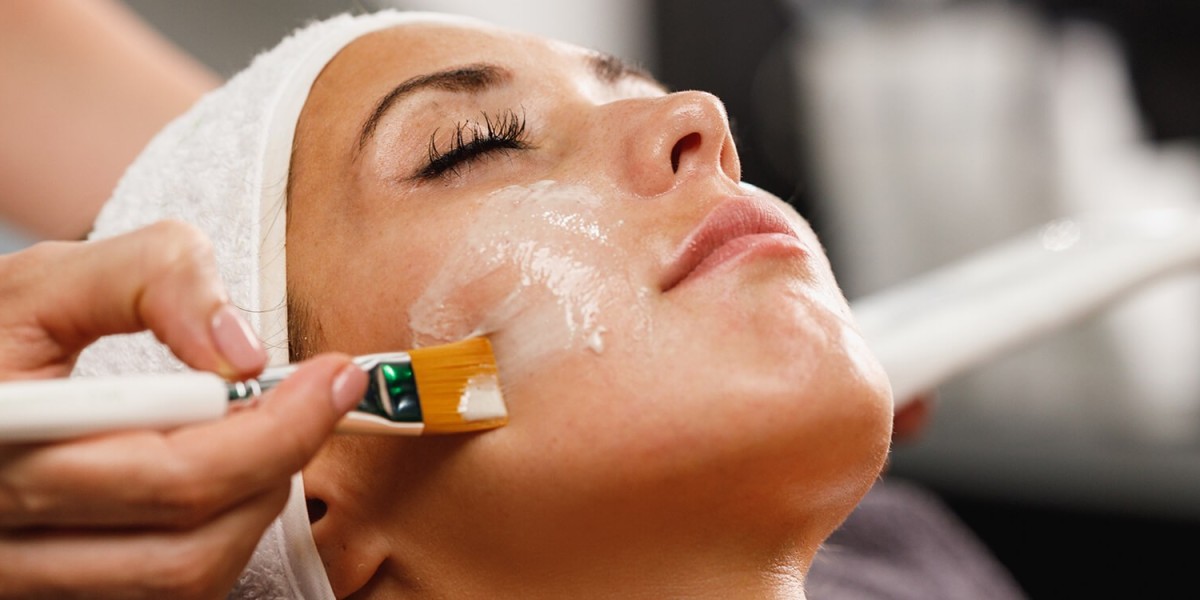 التقشير الكيميائي في الرياض لعلاج حب الشباب