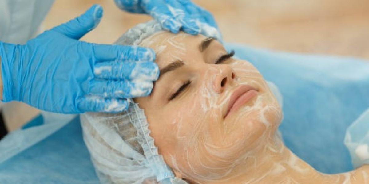 Achieve Smooth and Even Skin with Chemical Peels in Dubai
