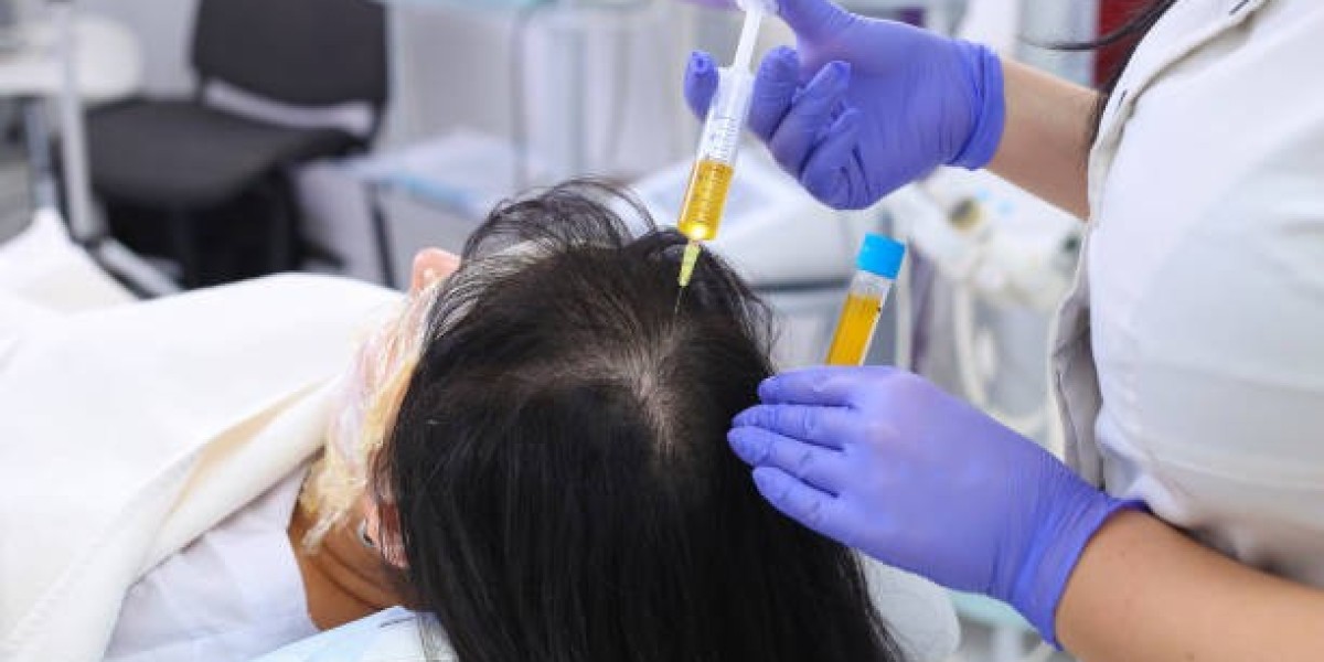 Boost Hair Density Safely with PRP Hair Treatment in Islamabad