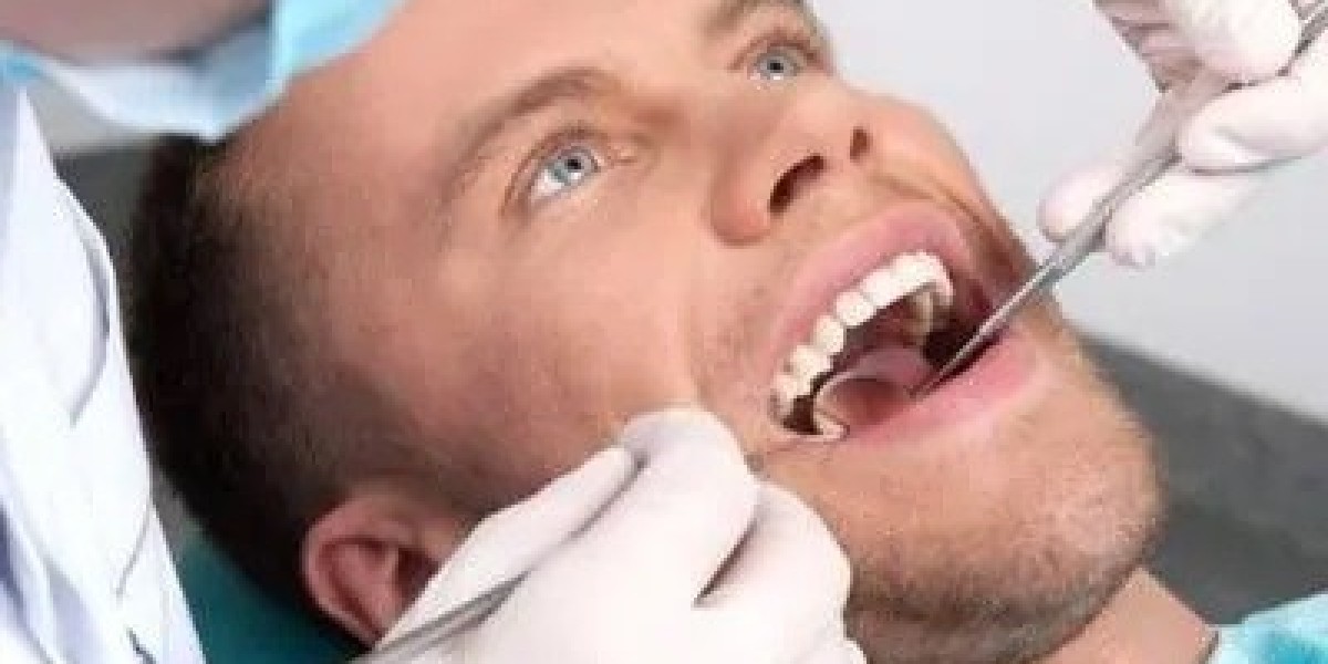 Root Canal Cost in Islamabad: What You Need to Know