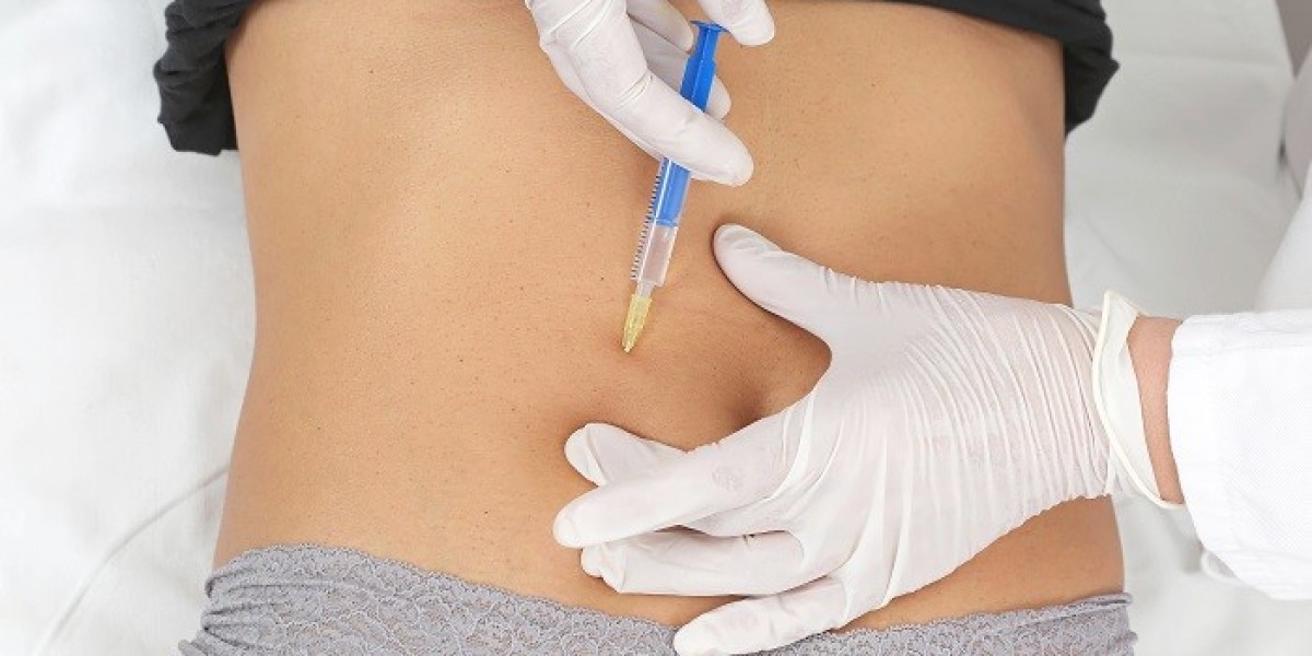 The Science Behind Fat Dissolving Injections in Riyadh