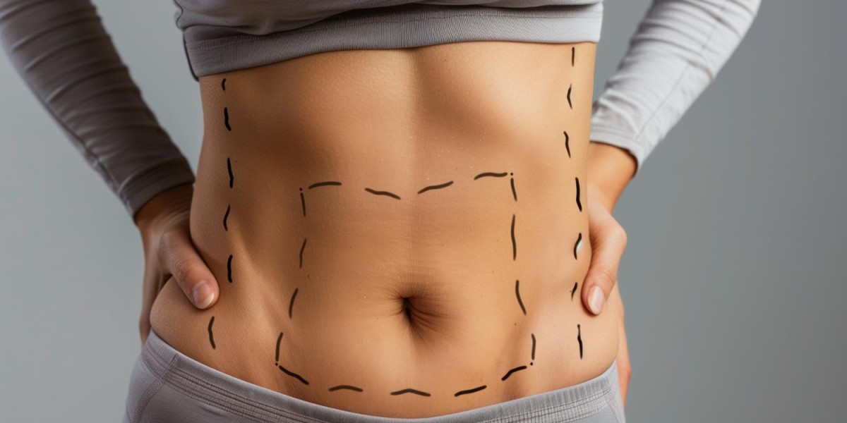 Why Liposuction in Dubai Is One of the Most Popular Body Contouring Treatments