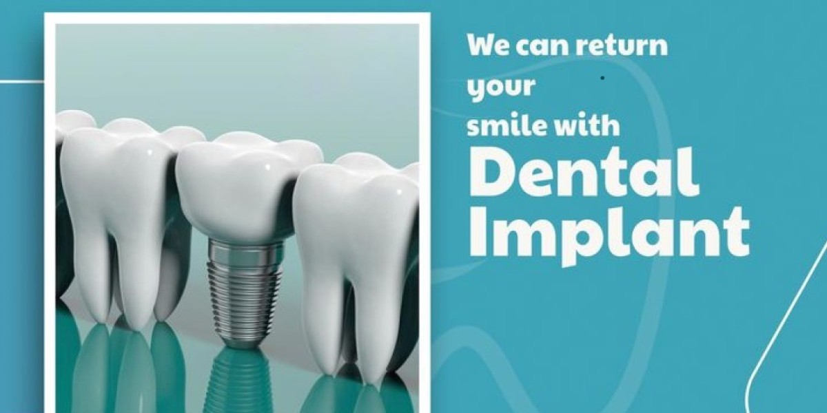 Best Dental Implants in Kondapur: A Complete Guide to Tooth Replacement