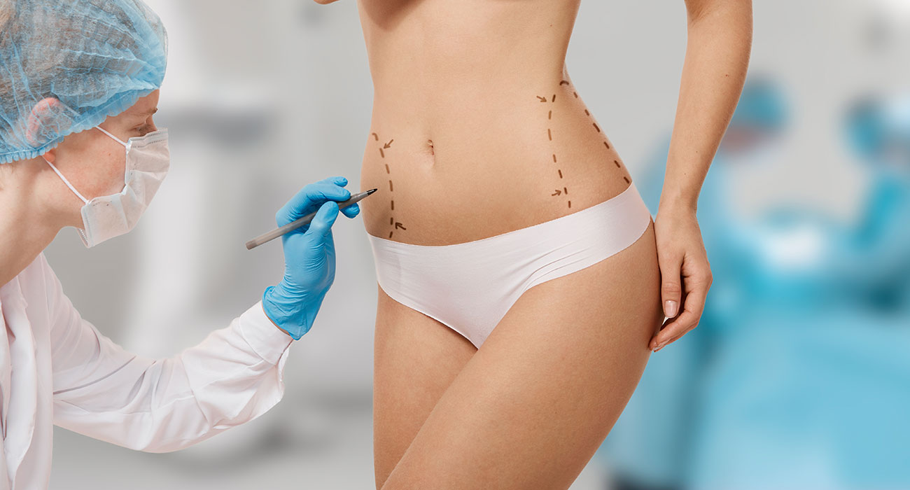 Liposuction Surgery in Delhi, India: Types, Cost & Risks