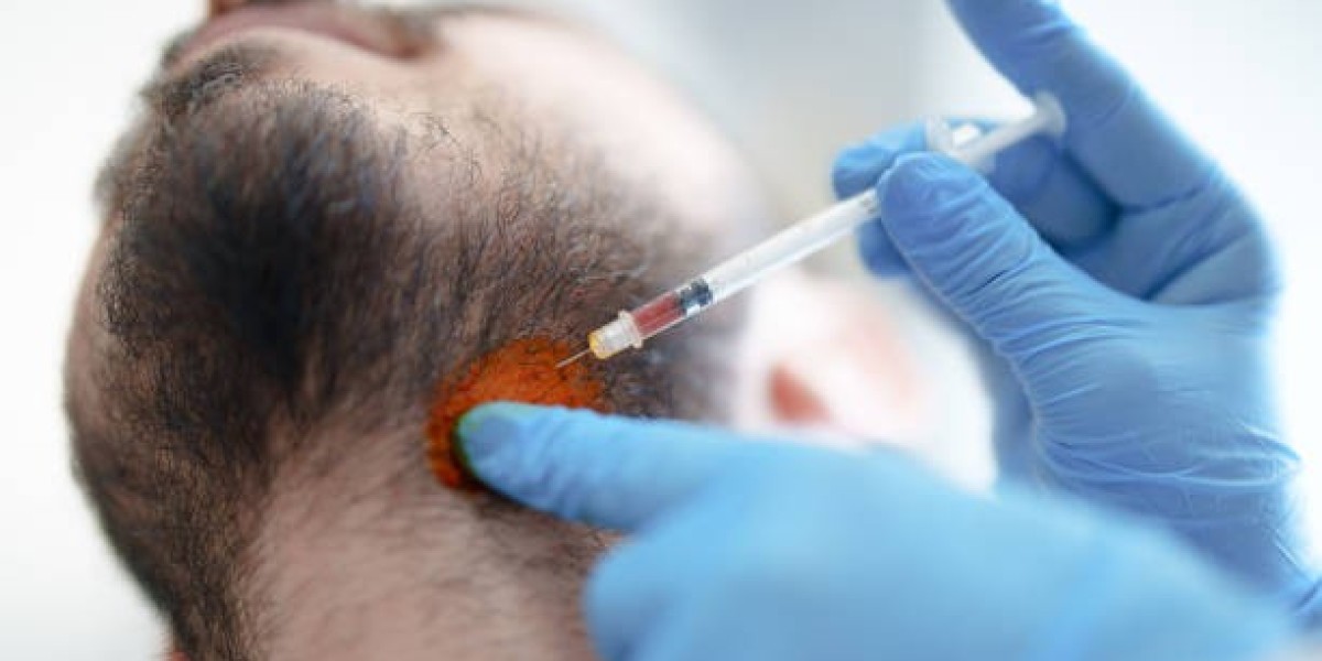 Beard Hair Transplant in Dubai: FAQs, Myths, and Facts You Should Know