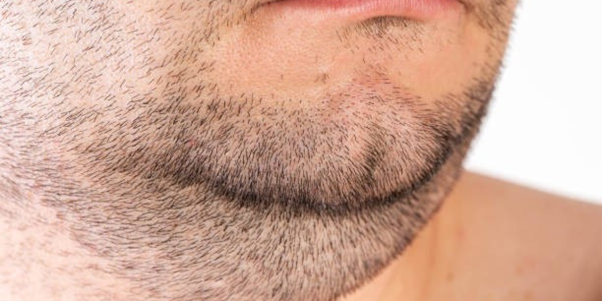 Choosing the Right Clinic for Your Beard Hair Transplant in Dubai