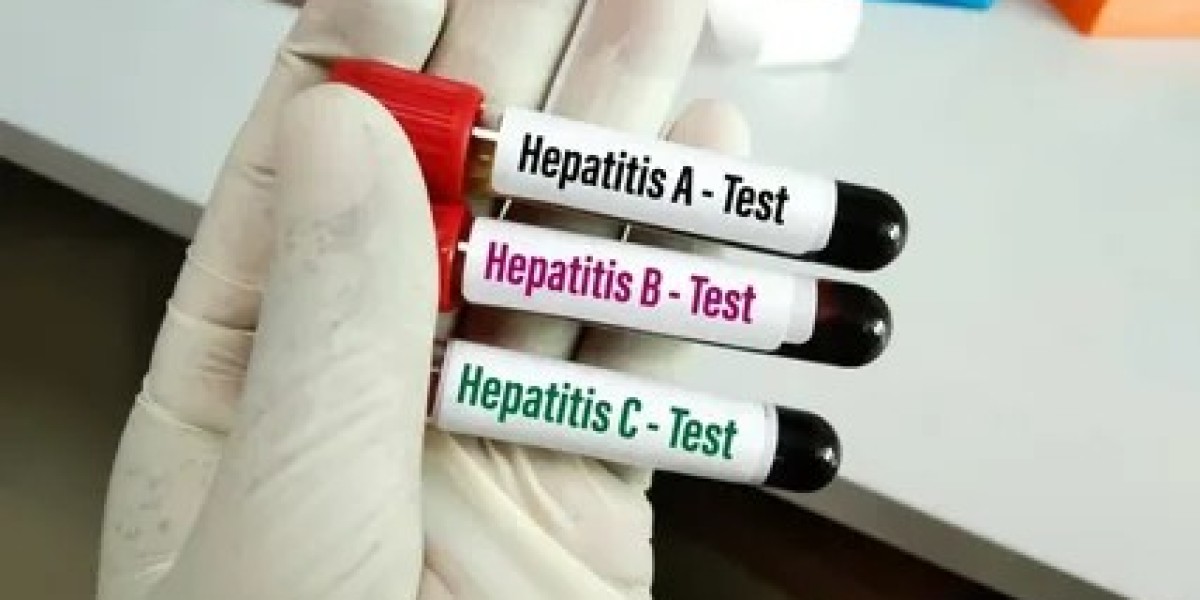 Hepatitis B Test in Dubai: Home Sample Collection Options