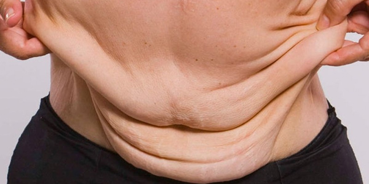 Bariatric Surgery in Islamabad: Stories of Rapid Transformation