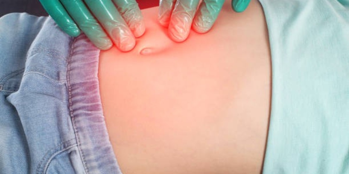 Hernia Surgery for Abdominal and Groin Conditions