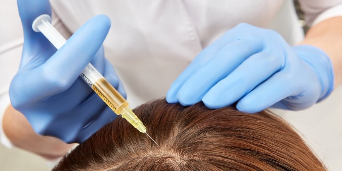 The Role of Growth Factors in PRP Hair Regeneration