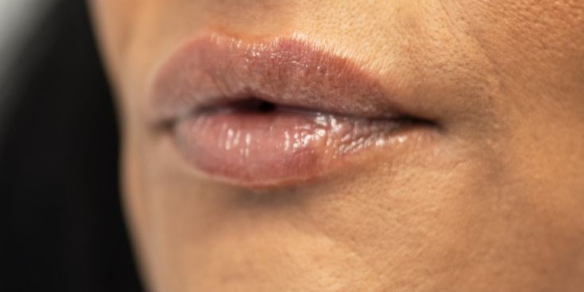 Lips That Speak Volumes: Smoker Lip Revival