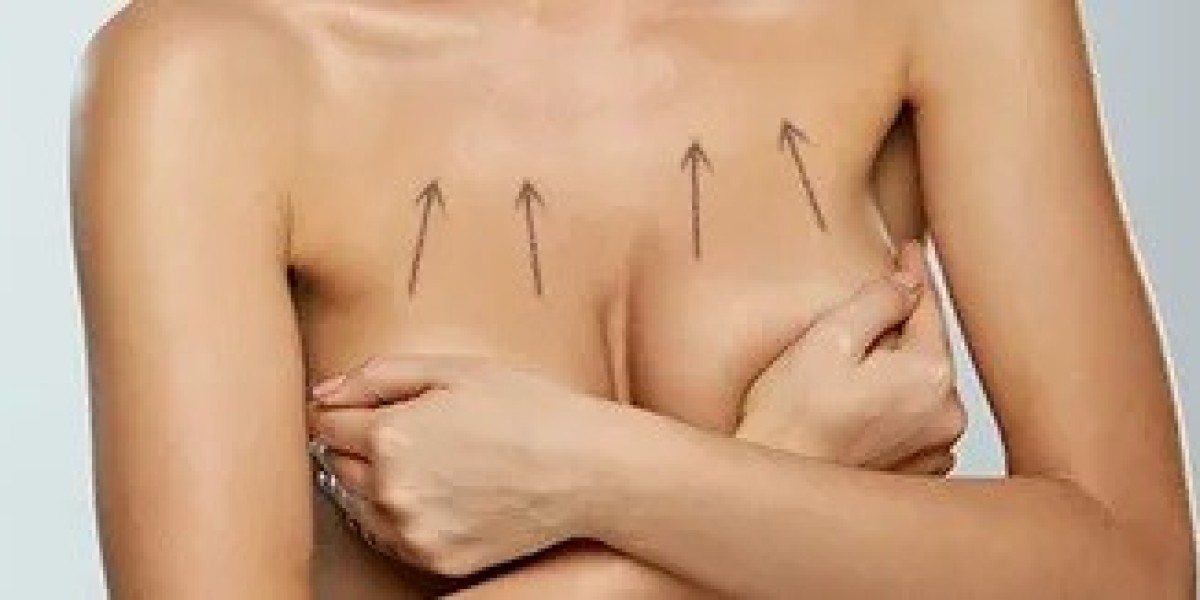 Can Breast Lift Surgery in Islamabad Correct Sagging After Pregnancy?