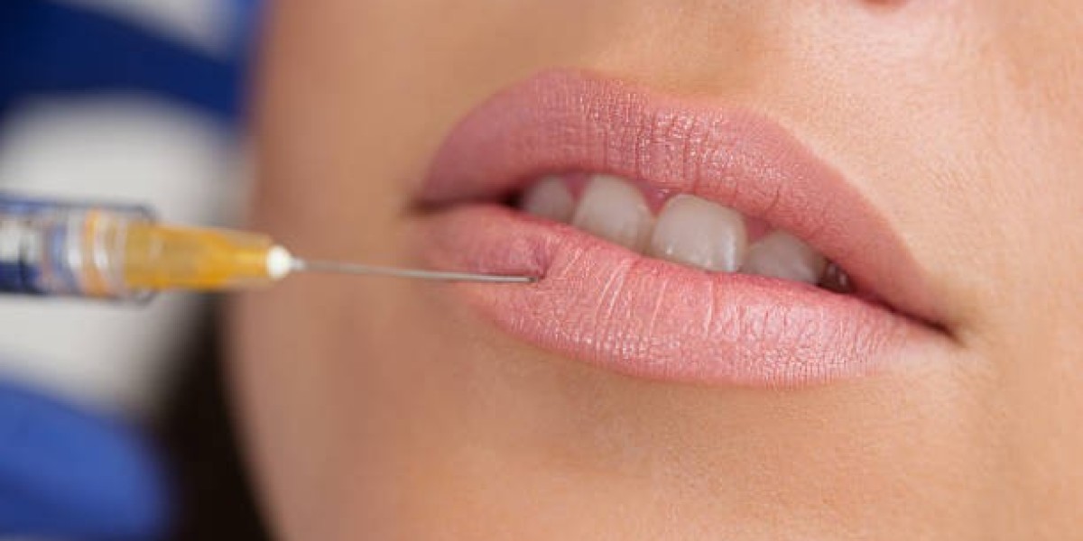 Emerging Trends in Russian Lip Fillers Aesthetics