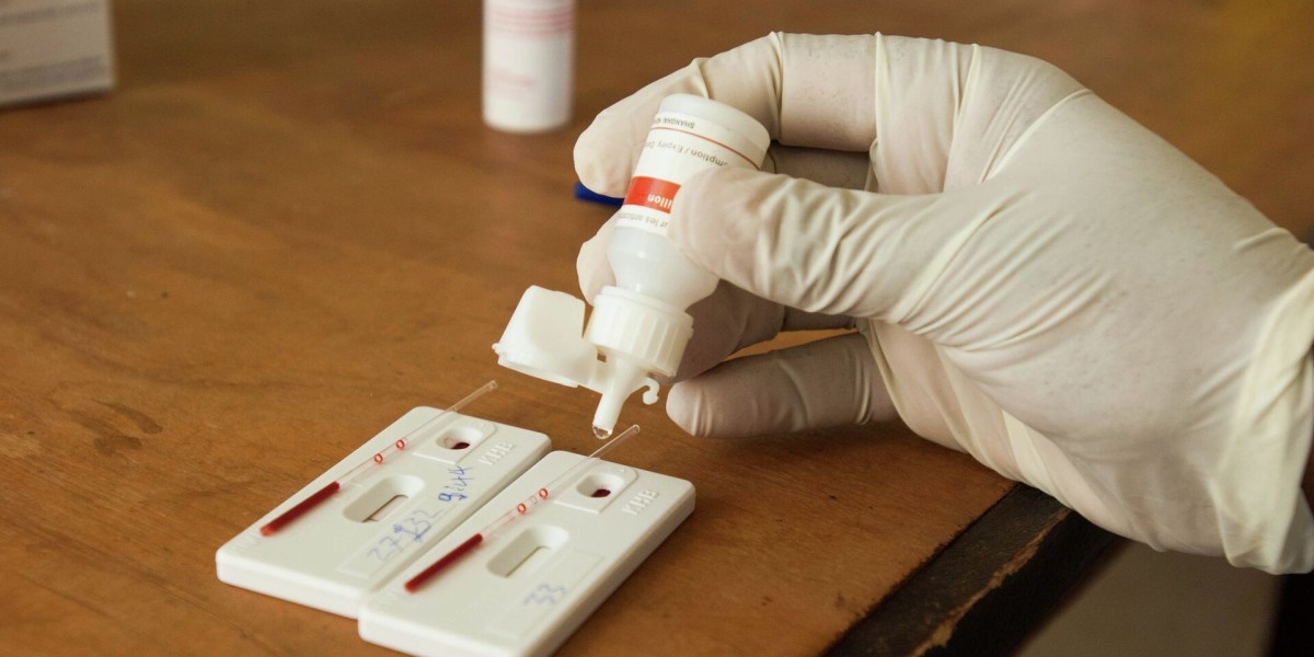 HIV Test Follow-Up: What Steps to Take After Testing?