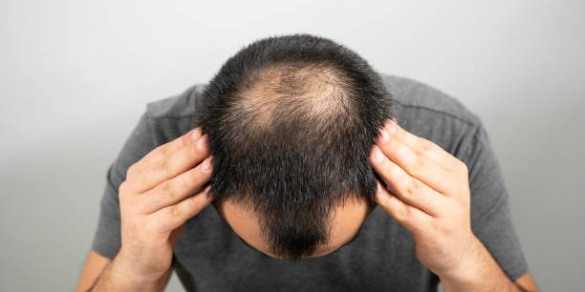Sustainable Hair Transplant Outcome Secrets